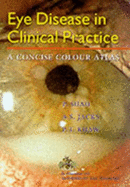 Eye Disease in Clinical Practice: A Concise Colour Atlas - Shah, P., and etc., and Jacks, A.