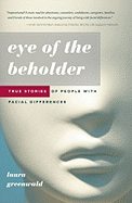 Eye of the Beholder: True Stories of People with Facial Differences