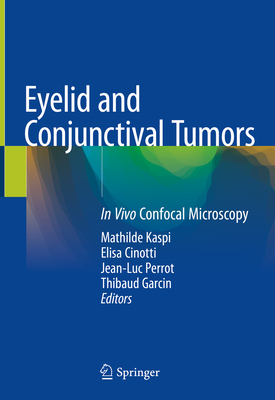 Eyelid and Conjunctival Tumors: In Vivo Confocal Microscopy - Kaspi, Mathilde (Editor), and Cinotti, Elisa (Editor), and Perrot, Jean-Luc (Editor)