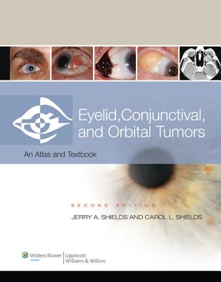 Eyelid, Conjunctival, and Orbital Tumors: An Atlas and Textbook - Shields, Jerry A, Dr., MD, and Shields, Carol L, Dr., MD