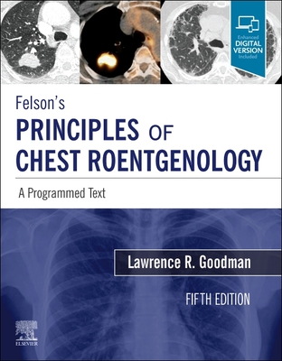 Felson's Principles of Chest Roentgenology, A Programmed Text: A Programmed Text - Goodman, Lawrence R.