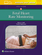 Fetal Heart Rate Monitoring