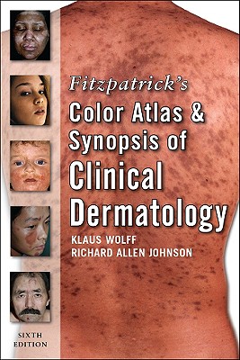 Fitzpatrick's Color Atlas and Synopsis of Clinical Dermatology - Wolff, Klaus, M.D., and Johnson, Richard Allen