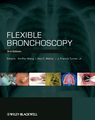 Flexible Bronchoscopy - Wang, Ko-Pen (Editor), and Mehta, Atul C (Editor), and Turner, J Francis (Editor)