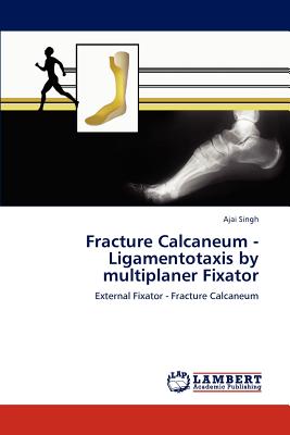 Fracture Calcaneum - Ligamentotaxis by multiplaner Fixator - Singh, Ajai