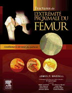 Fractures de l'Extrmit Proximale Du Fmur: Amliorer Le Devenir Du Patient