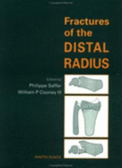 Fractures of the Distal Radius - Cooney, William P, III, MD, and Saffar, Phillipe