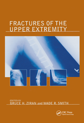 Fractures of the Upper Extremity - Ziran, Bruce H. (Editor)