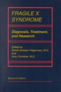 Fragile X Syndrome: Diagnosis, Treatment, and Research