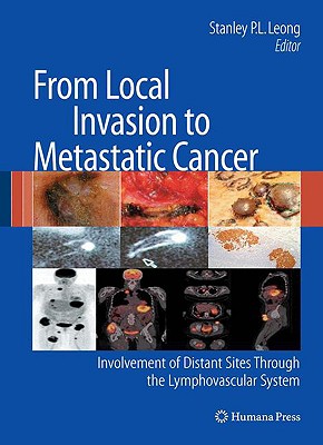 From Local Invasion to Metastatic Cancer: Involvement of Distant Sites Through the Lymphovascular System - Leong, Stanley P. L. (Editor)