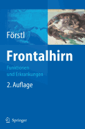 Frontalhirn: Funktionen Und Erkrankungen