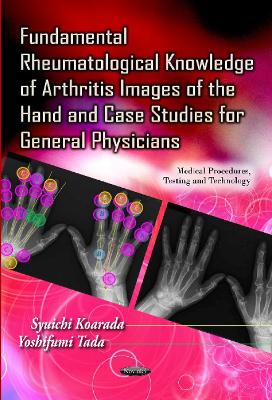 Fundamental Rheumatological Knowledge of Arthritis Images of the Hand & Case Studies for General Physicians - Koarada, Syuichi (Editor), and Tada, Yoshifumi (Editor)