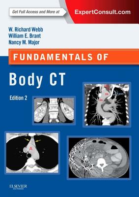 Fundamentals of Body CT - Webb, W Richard, M.D., and Brant, Wiliam E, MD, Facr, and Major, Nancy M, MD