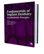 Fundamentals of Implant Dentistry: Prosthodontic Principles