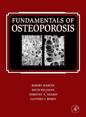 Fundamentals of Osteoporosis - Marcus, Robert, Dr., MD (Editor), and Feldman, David, Professor (Editor), and Nelson, Dorothy (Editor)