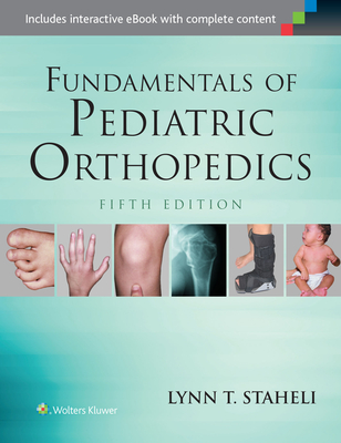 Fundamentals of Pediatric Orthopedics - Staheli, Lynn T, MD