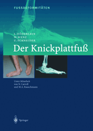 Fussdeformit?ten: Der Knickplattfuss