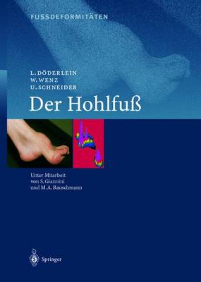 Fussdeformitaten: Der Hohlfuss - Giannini, S. (Assisted by), and Dderlein, L., and Rauschmann, M.A. (Assisted by)