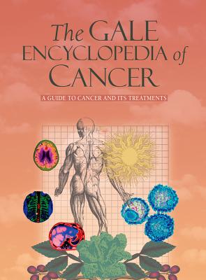 Gale Encyclopedia of Cancer - Gale (Editor)