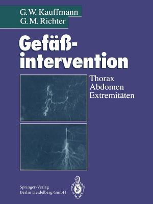 Gef??intervention: Thorax, Abdomen, Extremit?ten - Kauffmann, G.W., and Wenz, W. (Foreword by), and Allenberg, J.-R. (Contributions by)