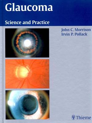 Glaucoma: Science and Practice - Morrison, John C, and Pollack, Irvin P