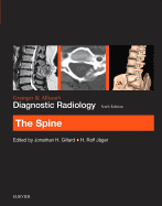 Grainger & Allison's Diagnostic Radiology: The Spine