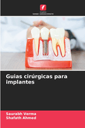 Guias cirrgicas para implantes