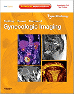 Gynecologic Imaging: Expert Radiology Series (Expert Consult Premium Edition - Enhanced Online Features and Print)