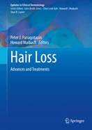 Hair Loss: Advances and Treatments