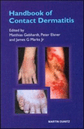 Handbook of Contact Dermatitis - Gebhardt, Matthias, and Elsner, Peter, MD, and Marks, James G, MD