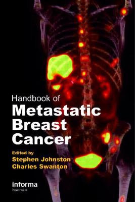 Handbook of Metastatic Breast Cancer - Swanton, Charles (Editor), and Johnston, Stephen R D (Editor)