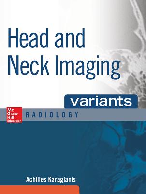 Head and Neck Imaging Variants - Karagianis, Achilles