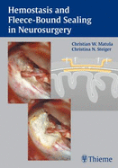 Hemostasis and Fleece-Bound Sealing in Neurosurgery
