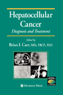 Hepatocellular Cancer; Diagnosis and Treatment