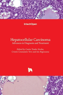 Hepatocellular Carcinoma: Advances in Diagnosis and Treatment - Streba, Costin Teodor (Editor), and Vere, Cristin Constantin (Editor), and Rogoveanu, Ion (Editor)