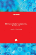 Hepatocellular Carcinoma: Basic Research