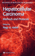 Hepatocellular Carcinoma: Methods and Protocols