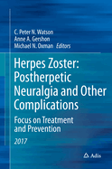 Herpes Zoster: Postherpetic Neuralgia and Other Complications: Focus on Treatment and Prevention