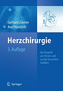 Herzchirurgie: Die Eingriffe Am Herzen Und an Den Herznahen Gef??en