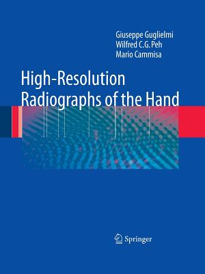 High-Resolution Radiographs of the Hand - Guglielmi, Giuseppe, and Peh, Wilfred C. G., and Cammisa, Mario