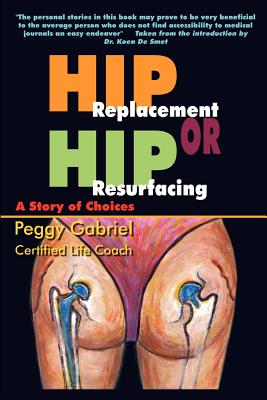 Hip Replacement or Hip Resurfacing: A Story of Choices - Gabriel, Peggy