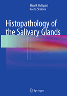 Histopathology of the Salivary Glands