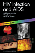HIV Infection and AIDS: Colour Guide - Murphy, Siobhan M, and Brook, Gary, MD, Frcp, and Birchall, Martin A, Frcs
