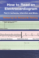 How to Read an Electrocardiogram: Part 2: Ischemia, Infarction and More.