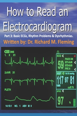 How to Read an Electrocardiogram - Part 3: Basic ECGs, Rhythm Problems & Dysrhythmias. - Fleming, Richard M