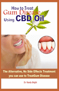 How to Treat Gum Disease Using CBD oil: The Alternative No Side Effects Treatment you can use to Treat Gum Disease