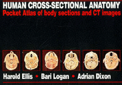 Human Cross-Sectional Anatomy: Pocket Atlas of Body Sections and CT Images - Ellis, Harold, and Logan, Bari, and Dixon, Adrian