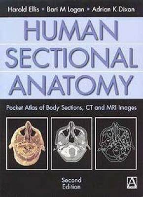 Human Sectional Anatomy: Pocket Atlas of Body Sections, CT and MRI Images - Ellis, Harold, and Logan, Bari M, and Dixon, Adrian K