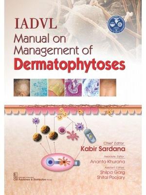 IADVL Manual on Management of Dermatophytoses - Sardana, Kabir