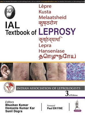 IAL Textbook of Leprosy - Kumar, Bhushan, and Kar, Hemanta Kumar, and Dogra, Sunil